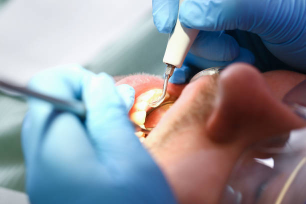 Best Emergency Treatment for Toothache in Runge, TX